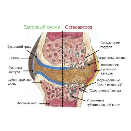 Гиалувит Хондро - раствор для инъекций, 2 мл